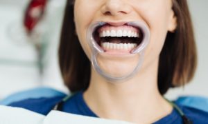 Enhancing Your Smile and Boosting Your Confidence